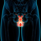 El 50% de los pacientes con cáncer de próstata en RD nunca ha sido evaluado por un urólogo