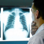 Médicos especialistas de Santiago advierten alto riesgo del uso de vape por jóvenes