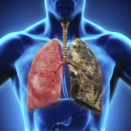 Un nuevo tratamiento aumenta la supervivencia en pacientes con cáncer de pulmón