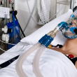 Muere mujer tras 22 años en coma