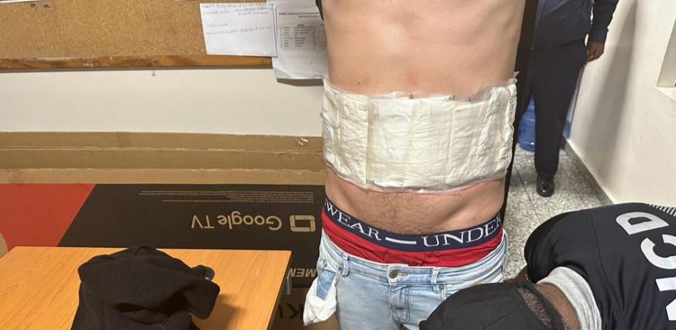 Extranjero detenido, fuente externa